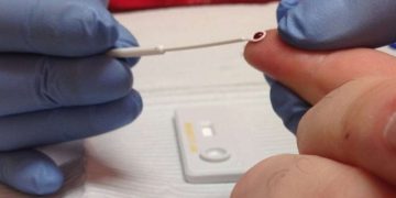 Programa de VIH y TBC en peligro: reducen casi la mitad del presupuesto para tratamiento en 2022